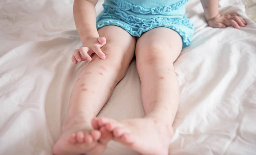 5 Tips To Prevent Bed Bugs In Child S Room Nursery Kid S Room Decor Ideas My Sleepy Monkey 5 Tips To Prevent Bed Bugs In Child S Room Nursery Kid S Room Decor Ideas My Sleepy Monkey